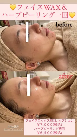 メンズ Salon de Lino 御器所のエステ・リラクイメージ