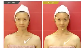 痛くないシミ取り 【荻窪】石橋のヘアスタイル