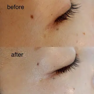 酵素エステ&糸脱毛 baby skinのエステ・リラクイメージ