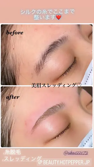 アイブロウ ハーブピーリング/韓国肌管理/フェイシャル/毛穴洗浄/眉毛/顔脱毛【糸脱毛専門】rev所属・ハーブピーリング🌹 毛穴洗浄❤️眉waxのエステ・リラクイメージ