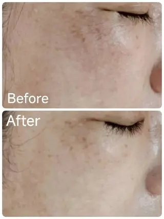 ICHOOSE/ 代々木上原のエステ・リラクイメージ