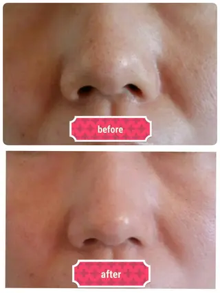 Y NAIL —BEAUTY SALON—所属・Y NAILのエステ・リラクイメージ