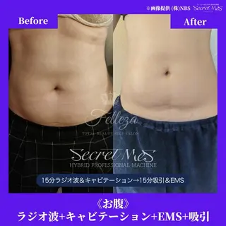 メンズ 有人型セルフサロン 脱毛/痩身/美顔のその他イメージ