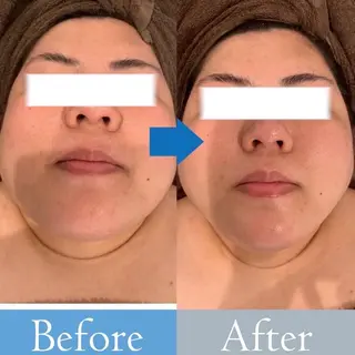 脱毛・ハイフ ・フェアリーのエステ・リラクイメージ