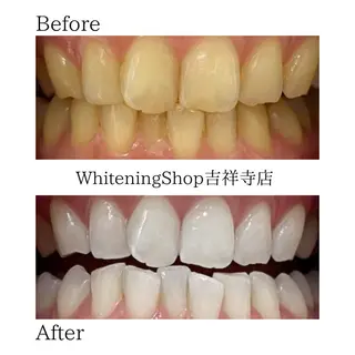 ホワイトニングショッ 吉祥寺2号店のその他イメージ