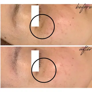 最新シミケアLily de pearlのエステ・リラクイメージ