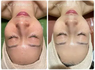 サロン・ド・ポラリス所属・サロンド ポラリスのエステ・リラクイメージ