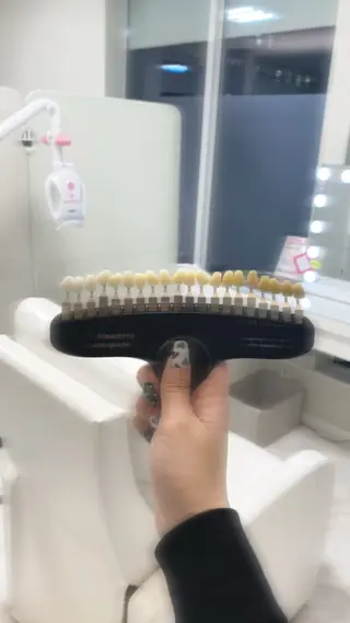 メンズ エクシアホワイトニング草津店所属・nanami -ホワイトニングのその他イメージ