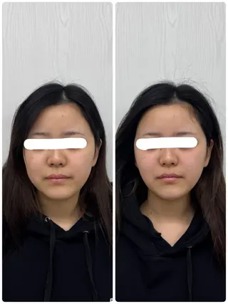 美容鍼×小顔矯正 ×美容整体　浜川泰仁のエステ・リラクイメージ