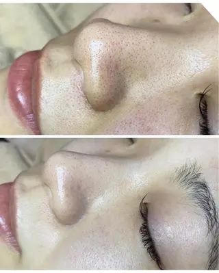 多摩境Beauty Salon  ViVi所属・多摩境ViVi chinamiのエステ・リラクイメージ