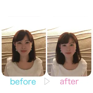 美容鍼とルート治療 iRu 金沢所属・中田 達也のその他イメージ