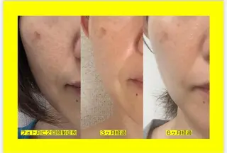 Alice城山台店所属・Alice 城山台店のエステ・リラクイメージ