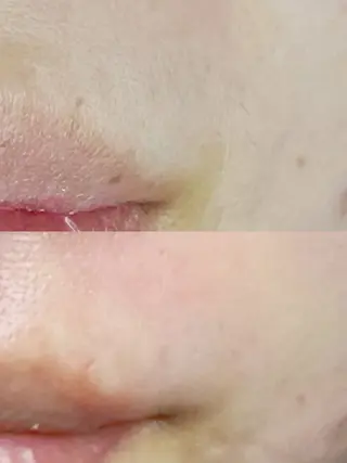 Hit. シュガーリング豊橋のエステ・リラクイメージ