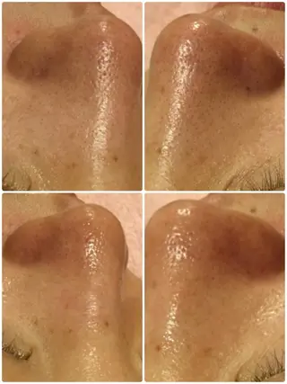 【リベルハーブピーリング認定店】敏感肌・美白脱毛専門店Dione立川店所属・Dione 立川店のエステ・リラクイメージ