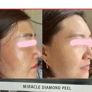 🍀 Momoのエステ・リラクイメージ