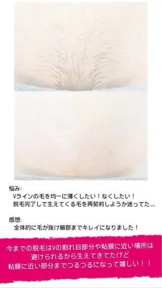 Hit. シュガーリング豊橋のエステ・リラクイメージ