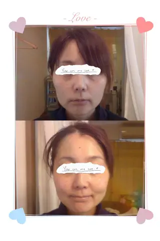 NORRA ノオラのエステ・リラクイメージ