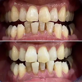 メンズ whiteclub.THREE福島店所属・whiteclub THREEのその他イメージ