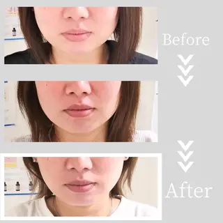 小顔・ツルツル素肌 ハリステリアのエステ・リラクイメージ