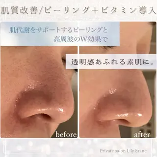 Lily branc 痩身/小顔/肌質改善のエステ・リラクイメージ