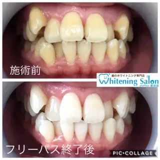 歯科レベルの白さ💎 ✨ホワイトニング豊田のエステ・リラクイメージ