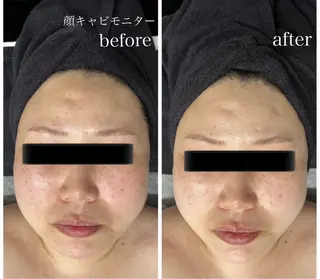 Genesis Plus大津京店のエステ・リラクイメージ