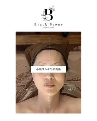 Black Stone所属・Black Stoneのエステ・リラクイメージ