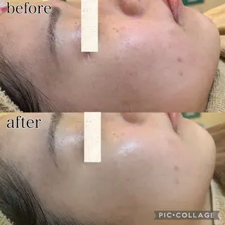 メンズ BeautySalon　heart所属・Beauty Salonheartのエステ・リラクイメージ