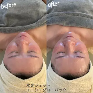 うなじ脱毛/美肌脱毛 LABELのエステ・リラクイメージ