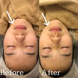 BestBelleꕤ 大阪福島/肌質改善のエステ・リラクイメージ