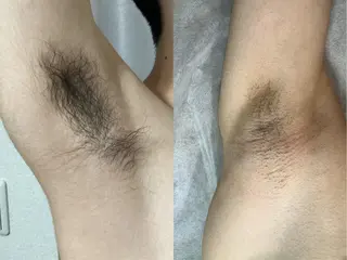 メンズ RIKKA所属・RIKKA☆脱毛/ アイブロウ/メイクのエステ・リラクイメージ