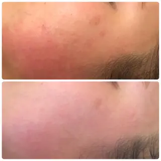 ラ・ルミエール所属・鈴木 えつこのエステ・リラクイメージ