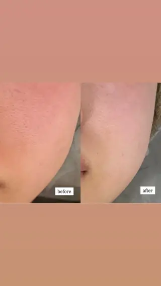 haneul ‹ハヌル›のエステ・リラクイメージ