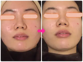 ロング カラー パーマ ヘアアレンジ メンズ キッズ ネイル マツエク・マツパ ‍痩身＆ボディ 結果出し🌟丹野のエステ・リラクイメージ