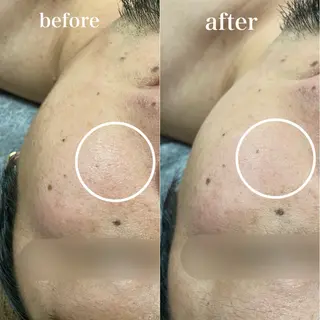 磐田｜LAYLA 一番丁寧な脱毛店のエステ・リラクイメージ