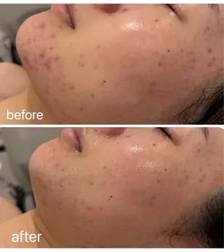 心も身体も美しく🌿 美肌&痩身ケア✨のエステ・リラクイメージ