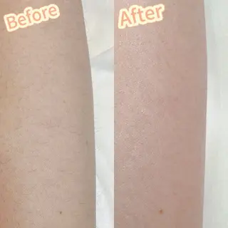 Hit. シュガーリング豊橋のエステ・リラクイメージ