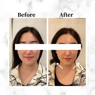 12Dハイフ💗 最強小顔のエステ・リラクイメージ