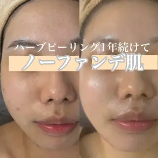 WHITE AQUA 北千住店のエステ・リラクイメージ