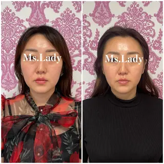 毛穴レス ハーブ＆ ワックス脱毛×光脱毛のエステ・リラクイメージ