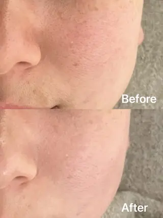 facial salon D 吉沢のエステ・リラクイメージ