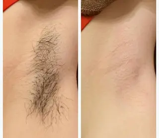 ラヴァコケット 梅田店のエステ・リラクイメージ