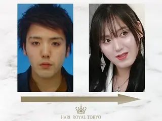 ハリロイヤルトーキョー武蔵小山所属・ニューハーフ鍼灸師 🖤🤍Saya🌹のエステ・リラクイメージ