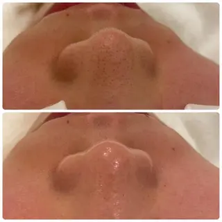 フェイシャル専門 肌質改善/プランスのエステ・リラクイメージ