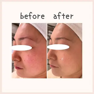 中澤 夢華のエステ・リラクイメージ