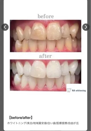 エミルカ　自由が丘店所属・ニキビ改善ハーブ🌿 ハナシマのその他イメージ