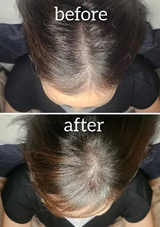 歯科提携セルフダック 宇都宮駒生店のエステ・リラクイメージ