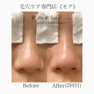 Eyelash salon MORE(モア)所属・安納 麻穂のエステ・リラクイメージ