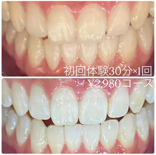 PLATINUM Beauty 横浜店所属・ホワイトニングルーム 横浜店のその他イメージ