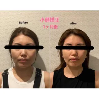 チキバン美容鍼灸整体 サロン心斎橋店のエステ・リラクイメージ